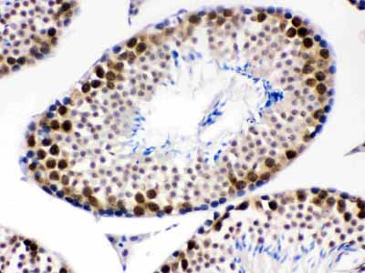2 - Anti-CDK1 Picoband Antibody ABO12220