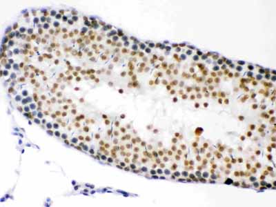 2 - Anti-CDK1 Picoband Antibody ABO12220