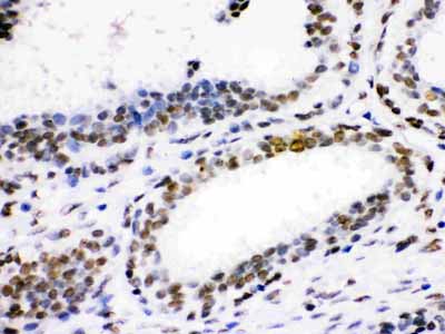 2 - Anti-CDK1 Picoband Antibody ABO12220
