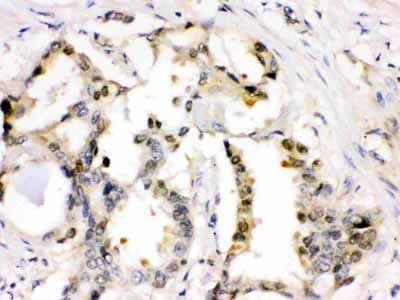 2 - Anti-Cdk2 Picoband Antibody ABO12221