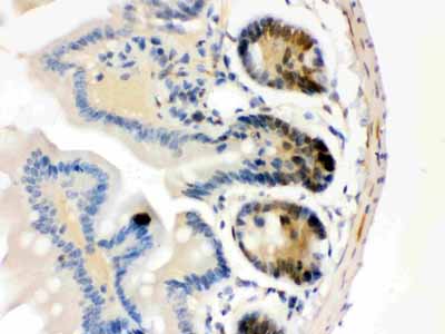 2 - Anti-Cdk4 Picoband Antibody ABO12222