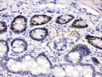 2 - Anti-Cdk4 Picoband Antibody ABO12222