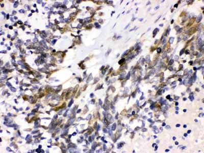 2 - Anti-Cdk4 Picoband Antibody ABO12222
