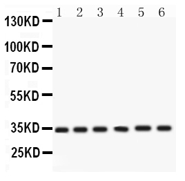 1 - Anti-Cdk4 Picoband Antibody ABO12222