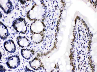 2 - Anti-Cdk9 Picoband Antibody ABO12224