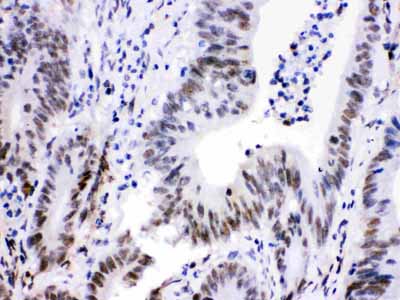 2 - Anti-Cdk9 Picoband Antibody ABO12224