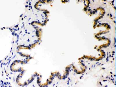2 - Anti-COMT Picoband Antibody ABO12226
