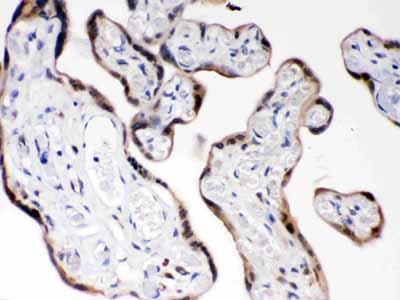 2 - Anti-COMT Picoband Antibody ABO12226