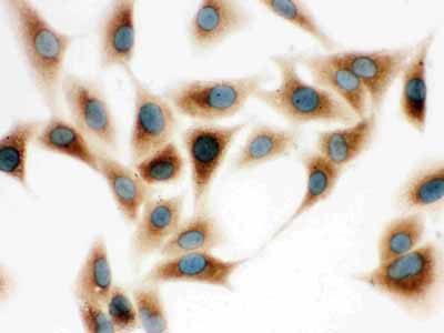 2 - Anti-COMT Picoband Antibody ABO12226