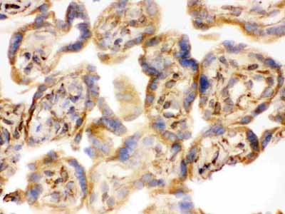 2 - Anti-COMT Picoband Antibody ABO12226