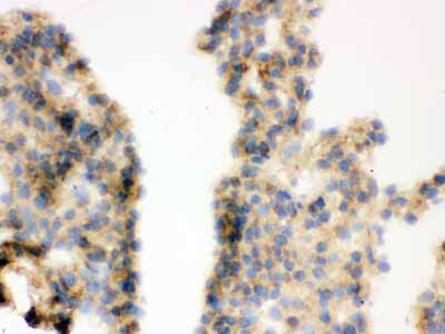 2 - Anti-COMT Picoband Antibody ABO12226