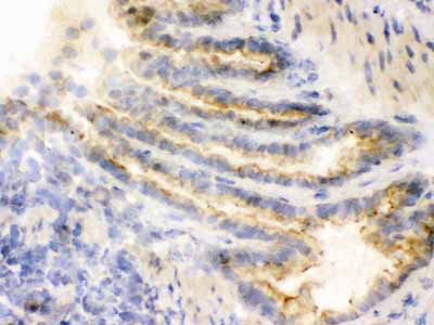 2 - Anti-COMT Picoband Antibody ABO12226