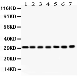 1 - Anti-COMT Picoband Antibody ABO12226
