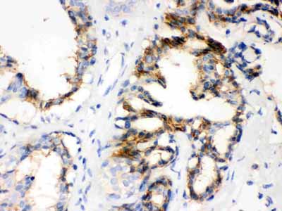2 - Anti-CTGF Picoband Antibody ABO12228