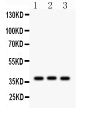 1 - Anti-CTGF Picoband Antibody ABO12228