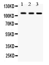 1 - Anti-CYLD Picoband Antibody ABO12230