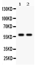 1 - Anti-CYP1A2 Picoband Antibody ABO12232