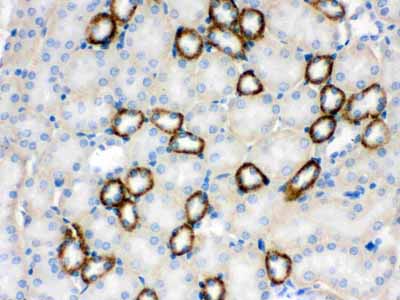 2 - Anti-CYP1B1 Picoband Antibody ABO12233