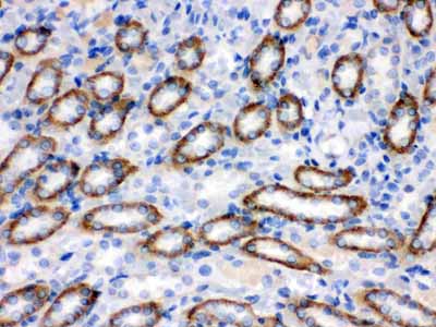 2 - Anti-CYP1B1 Picoband Antibody ABO12233