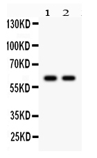 1 - Anti-CYP1B1 Picoband Antibody ABO12233