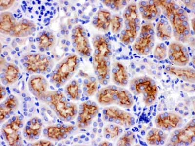 2 - Anti-CYP24A1 Picoband Antibody ABO12234