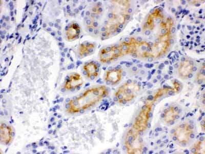 2 - Anti-CYP24A1 Picoband Antibody ABO12234
