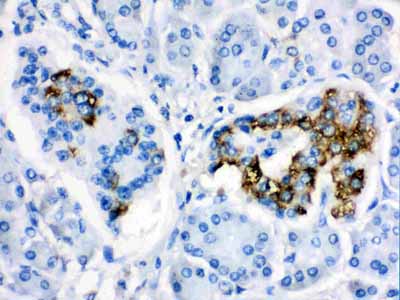 2 - Anti-CYP24A1 Picoband Antibody ABO12234