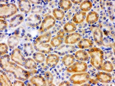 2 - Anti-CYP27B1 Picoband Antibody ABO12235