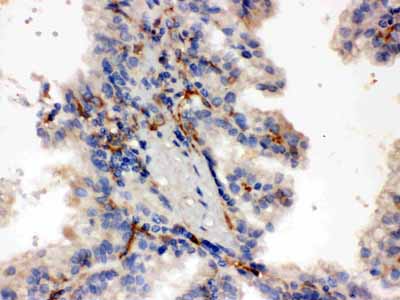 2 - Anti-CYP27B1 Picoband Antibody ABO12235
