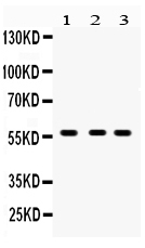 1 - Anti-CYP27B1 Picoband Antibody ABO12235