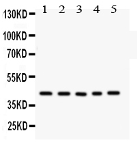 1 - Anti-CYR61/CCN1 Antibody ABO12236