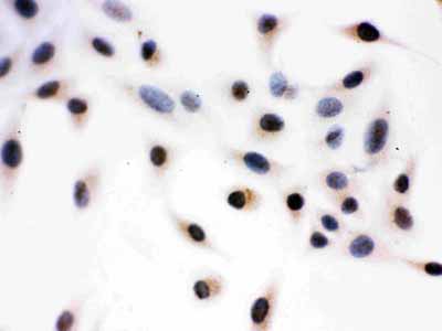8 - Anti-Daxx Picoband Antibody ABO12237