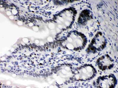 2 - Anti-Daxx Picoband Antibody ABO12237