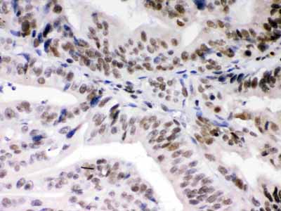 2 - Anti-Daxx Picoband Antibody ABO12237