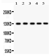 1 - Anti-Daxx Picoband Antibody ABO12237
