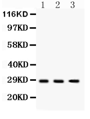 1 - Anti-DKK2 Picoband Antibody ABO12238