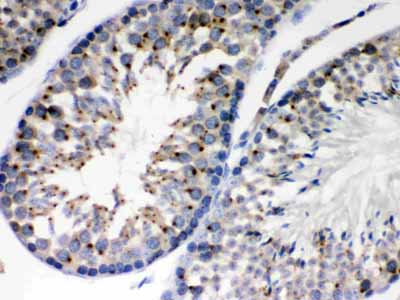 2 - Anti-EBAG9 Picoband Antibody ABO12240