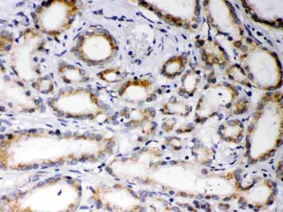 2 - Anti-EBAG9 Picoband Antibody ABO12240