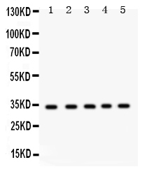 1 - Anti-EBAG9 Picoband Antibody ABO12240
