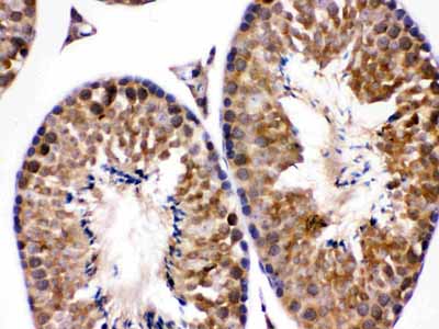 2 - Anti-EDNRB Picoband Antibody ABO12241