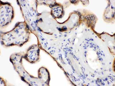 2 - Anti-EDNRB Picoband Antibody ABO12241