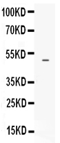 1 - Anti-EDNRB Picoband Antibody ABO12241