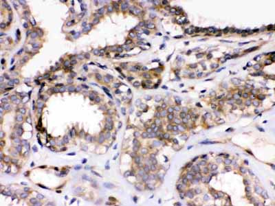 2 - Anti-Parvin Alpha Picoband Antibody ABO12242