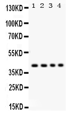 1 - Anti-Parvin Alpha Picoband Antibody ABO12242