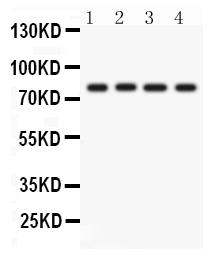 1 - Anti-PKC Eta Picoband Antibody ABO12243