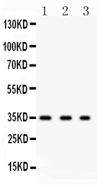 1 - Anti-SPARC Picoband Antibody ABO12246