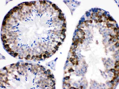 2 - Anti-Stathmin 1 Picoband Antibody ABO12247