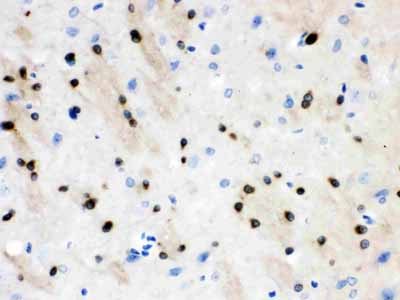 2 - Anti-Stathmin 1 Picoband Antibody ABO12247