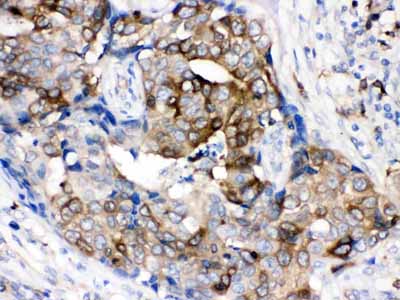 2 - Anti-Stathmin 1 Picoband Antibody ABO12247