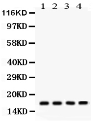 1 - Anti-Stathmin 1 Picoband Antibody ABO12247